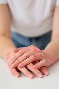 Free From Common Irritants